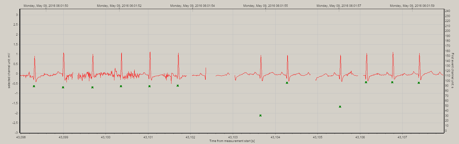 ECG analysis software that can deal with intermittent signals. 